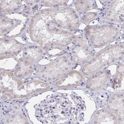 ZNF182 Antibody, Novus Biologicals:Antibodies:Primary Antibodies
